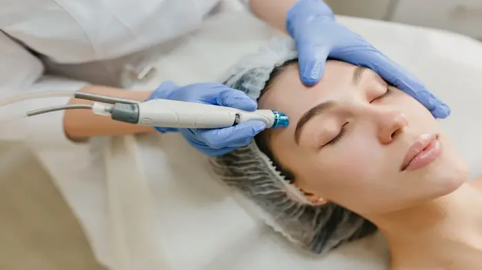 Microneedling treatment at Beauty by Catherine in Harrietsham