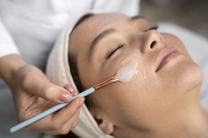 Chemical Peel in Harrietsham
